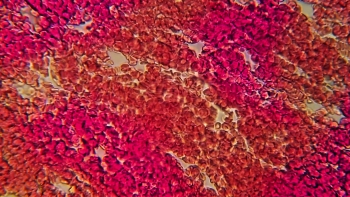 The Complex Screenshot